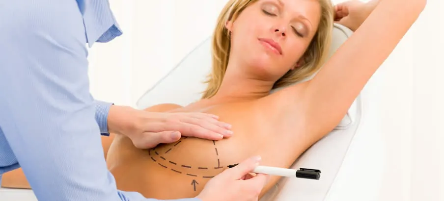 breast surgery